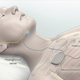 Illustration for article titled This Electronic Sleep Apnea Cure Is Like Auto-Pilot for Breathing